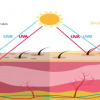 Da khô tróc vảy - Cách ngăn ngừa và chăm sóc hiệu quả