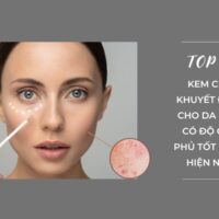 Top 9 kem che khuyết điểm cho da mụn có độ che phủ tốt nhất hiện nay