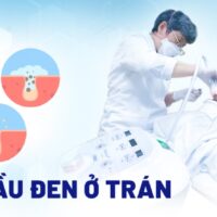 Mụn đầu đen ở trán: Nguyên nhân, dấu hiệu và cách trị dứt điểm