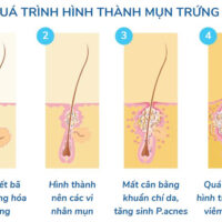 Các tin tức tại MEDlatec