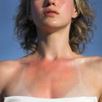 ‘Cứu nguy’ làn da với 10 cách nhả nắng tại nhà đơn giản nhất