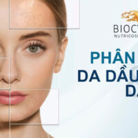 Cách phân biệt da dầu và da khô đơn giản dành cho các nàng