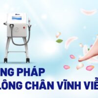 Triệt lông chân vĩnh viễn là gì? 4 cách được ưa chuộng hiện nay