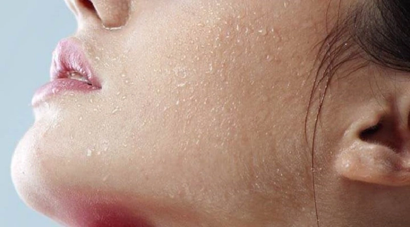 Da mặt sần sùi: Nguyên nhân, dấu hiệu và cách chữa trị