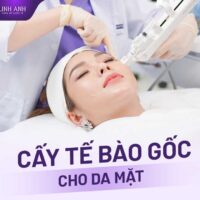 Cấy tế bào gốc cho da mặt bao nhiêu tiền? Bảng giá mới nhất 2024