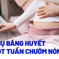 Băng huyết sau một tuần chườm nóng bụng