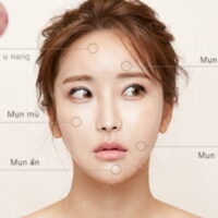 Các Bước Skincare Cho Da Dầu Mụn Ngày & Đêm Đúng Chuẩn