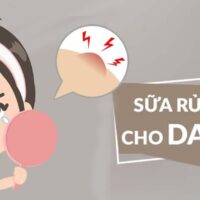 Top 10 sữa rửa mặt dịu nhẹ cho da dầu mụn