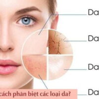 Phân biệt các loại da mặt với 6 cách đơn giản và cách chăm sóc