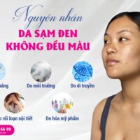 Da sạm đen không đều màu – TOP 7 cách giúp da sáng hồng rạng rỡ