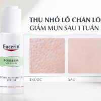 Serum Eucerin Trị Mụn Có Những Loại Nào? Có Tốt Không?