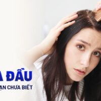 Gàu là gì? 10 nguyên nhân và triệu chứng phổ biến bạn cần biết