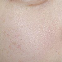 10 loại mặt nạ cho da khô sần sùi dưỡng da căng mướt tự nhiên