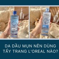 Da dầu mụn nên dùng tẩy trang Loreal nào?