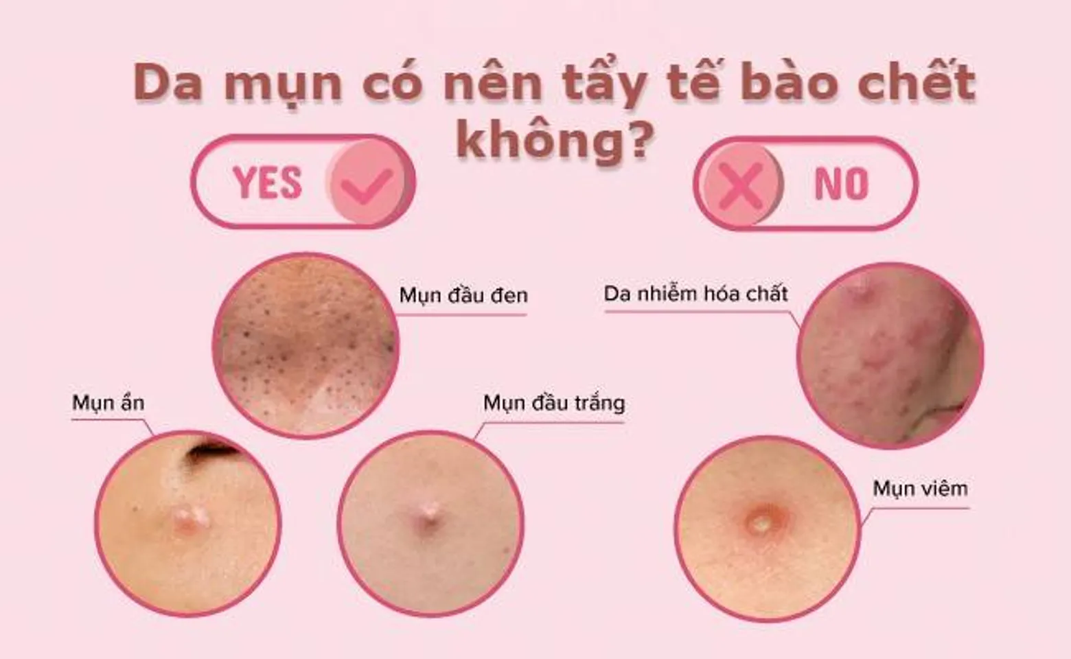 Top 16 tẩy tế bào chết cho da dầu mụn an toàn, hiệu quả