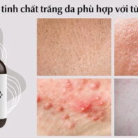 Top 1 Tinh Chất Trắng Da Của Đức Tốt Nhất Hiện Nay | Eucerin