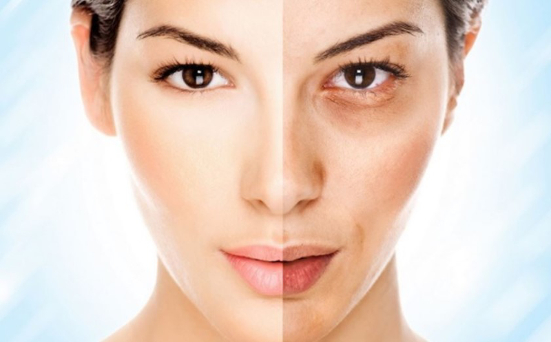 Dấu hiệu da mặt đang thải độc là gì? Thải độc da như thế nào cho hiệu quả?