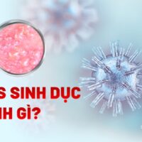 Bệnh Herpes sinh dục: Nguyên nhân, triệu chứng, chẩn đoán, phòng ngừa