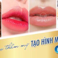 Phẫu Thuật Thẩm Mỹ Môi – 6 Nguyên Tắc Không Thể Bỏ Qua