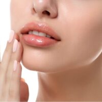 Thận trọng tránh các tác dụng ngoại ý khi phun môi phủ bóng collagen